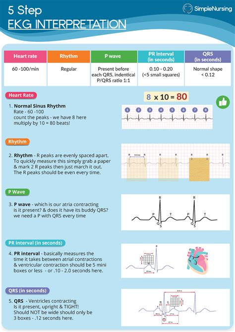 ecg interpretation for nurses.